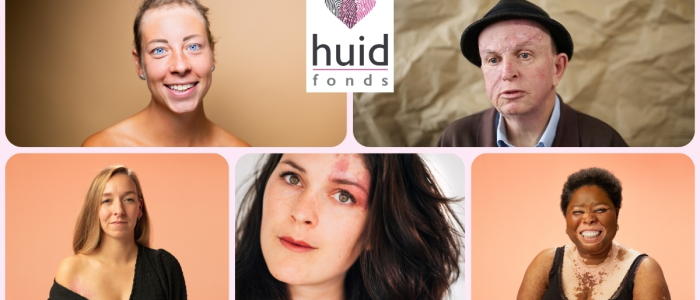 Stichting Nationaal Huidfonds